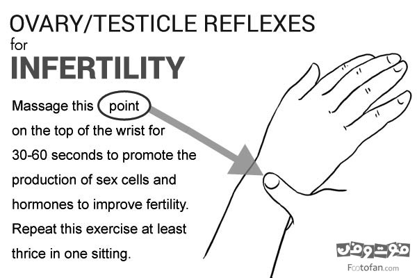 ۱۰-infertility