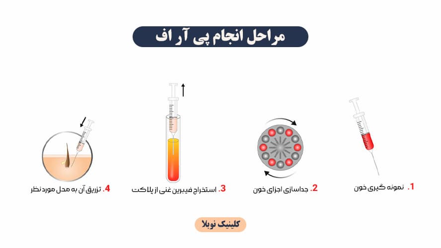 پی ار اف