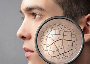 چگونه خشکی پوست را در زمستان رفع کنیم؟
