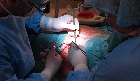 عمل جراحی جنین