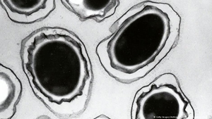 اشتباه ارتش آمریکا در انتقال نمونه زنده باکتری سیاه‌زخم