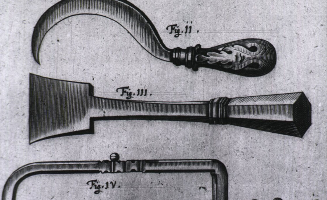 برگی از تاریخ: ابزار پزشکی رعب‌آور و عجیب قدیمی