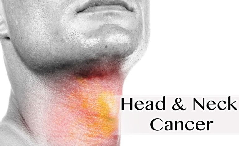 تشخیص به موقع سرطان سر و گردن
