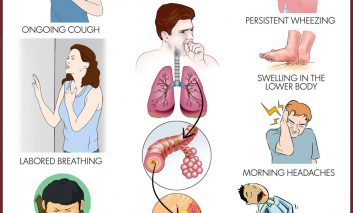اگر این ۸ علامت را در خود مشاهده کردید، احتمالا ریه شما در معرض خطر است