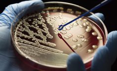 افزایش ظهور اَبَر میکروب‌ها: مقابله با بحران مقاومت آنتی بیوتیکی