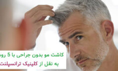 کاشت مو بدون جراحی با 5 روش به نقل از کلینیک ترانسپلنت