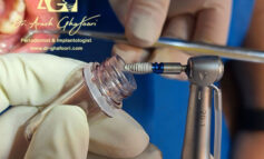 روش نوین کاشت دندان به روش دیجیتالی توسط دکتر آرش غفوری