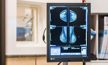 تشخیص 100 درصد مشکلات بافت پستان با ماموگرافی تابا