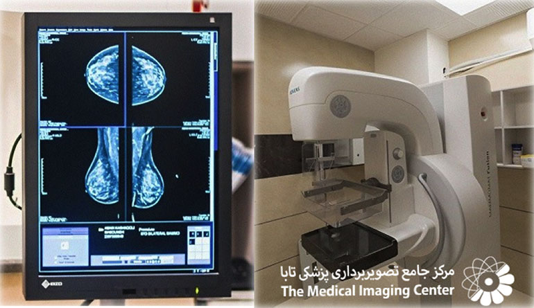 ماموگرافی تابا؛ آیا بهترین مرکز رادیولوژی در ایران را می شناسید؟