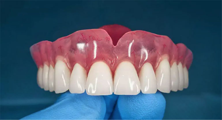 بررسی ویژگی‌ های دندان مصنوعی