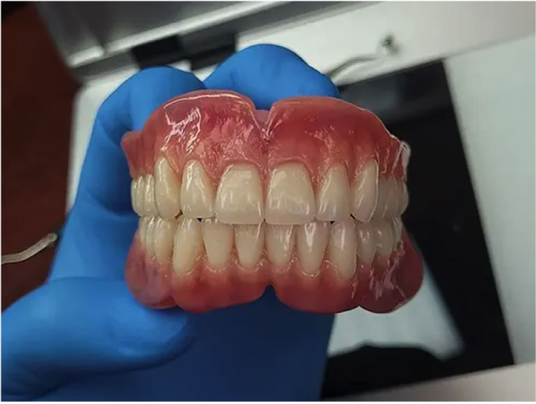 هنگام تهیه دندان مصنوعی به چه فاکتورهایی توجه داشته باشیم؟