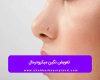 تعویض نگین میکرودرمال