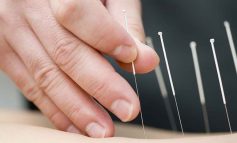 5 کاربرد اصلی طب سوزنی که باید بشناسید!