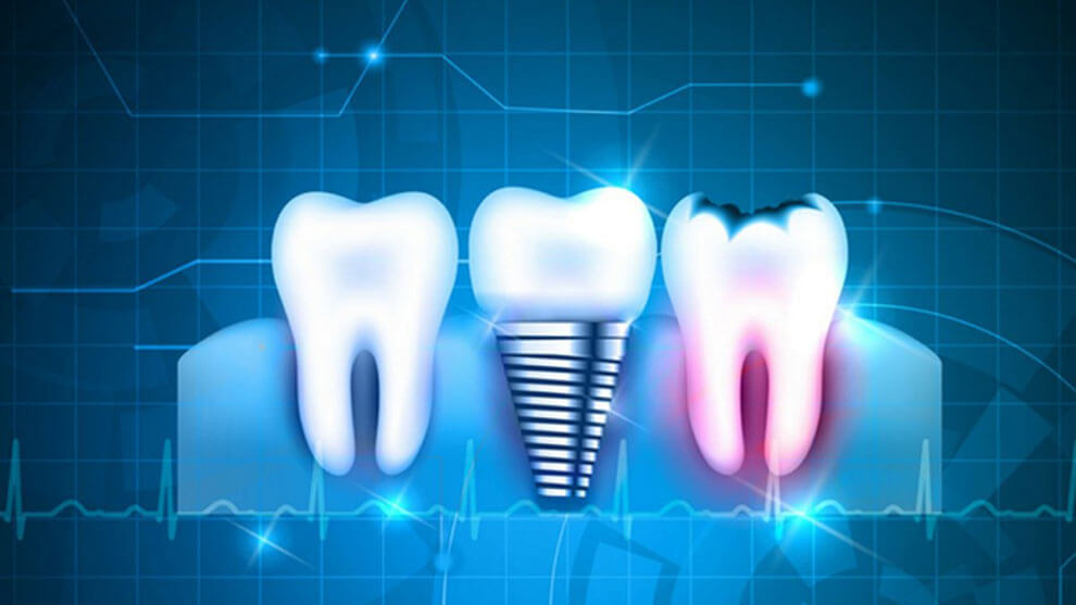 دندان پزشکی دیجیتال چیست: