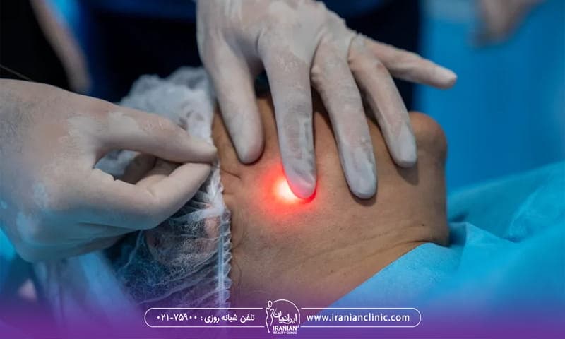 خانم مسنی که پوست او چروک های زیادی دارد و پزشک صورت او را اندولیفت می کند