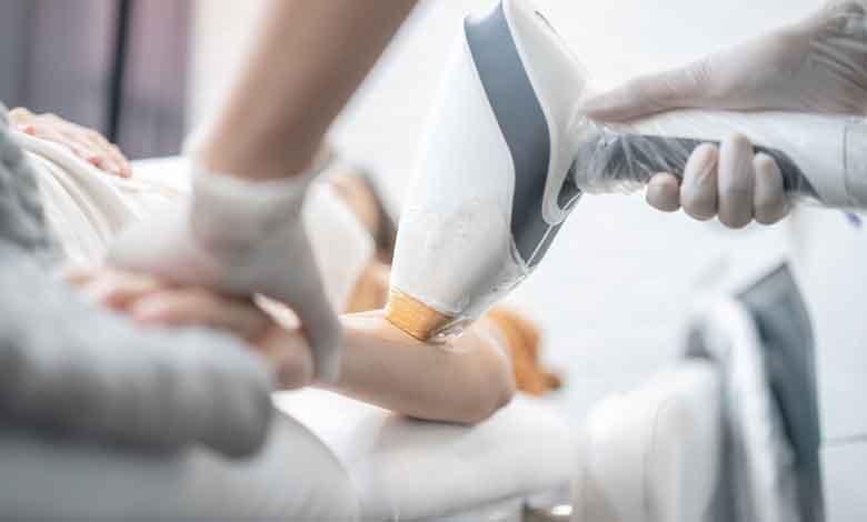 لیزر موهای زائد