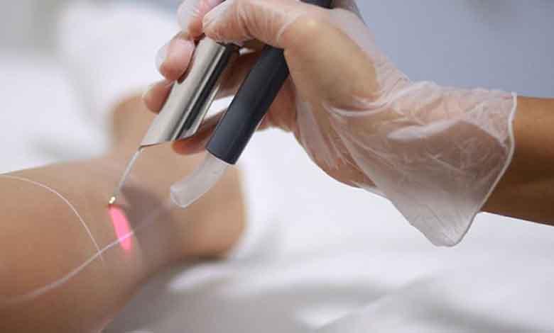 بهترین روش حذف موهای زائد سفید