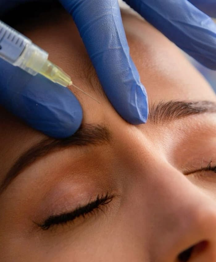 تزریق بوتاکس پیشانی و خط اخم در اصفهان